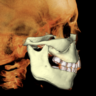 Anatomage In Vivo Viewer