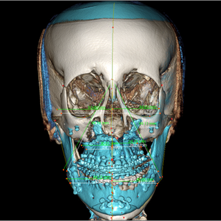 Anatomage invivo viewer download Anatomage invivo viewer download
