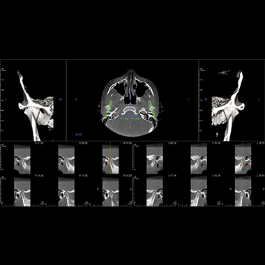 Anatomage in vivo viewer download free