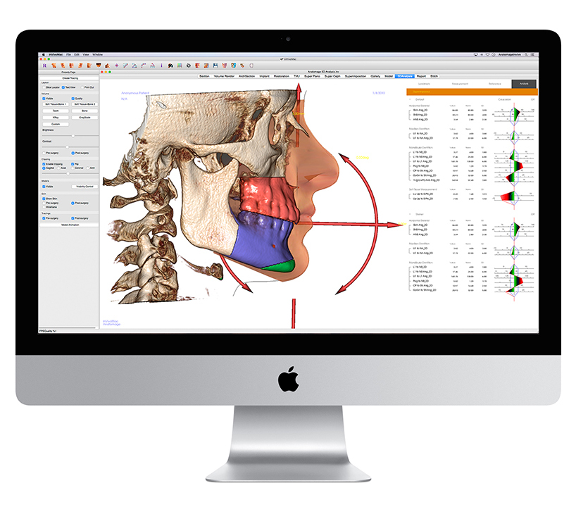 Anatomage Anatomage