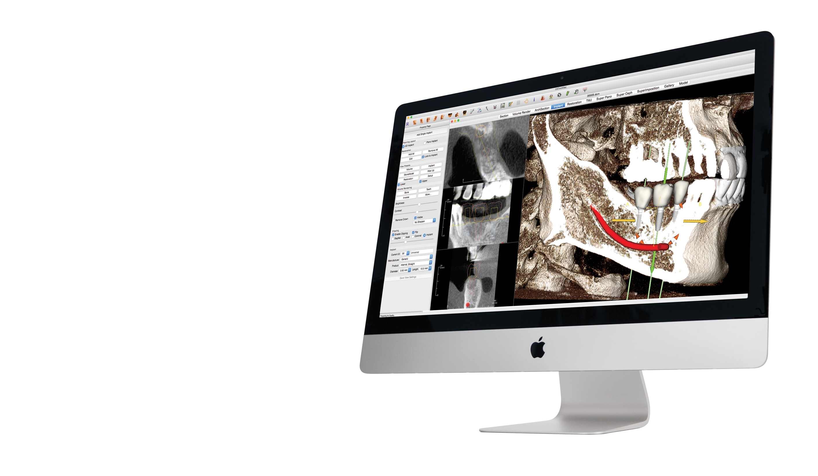 Anatomage Dental Home Anatomage