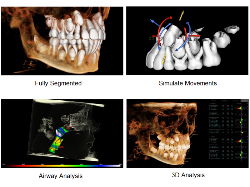 Anatomage in vivo viewer download