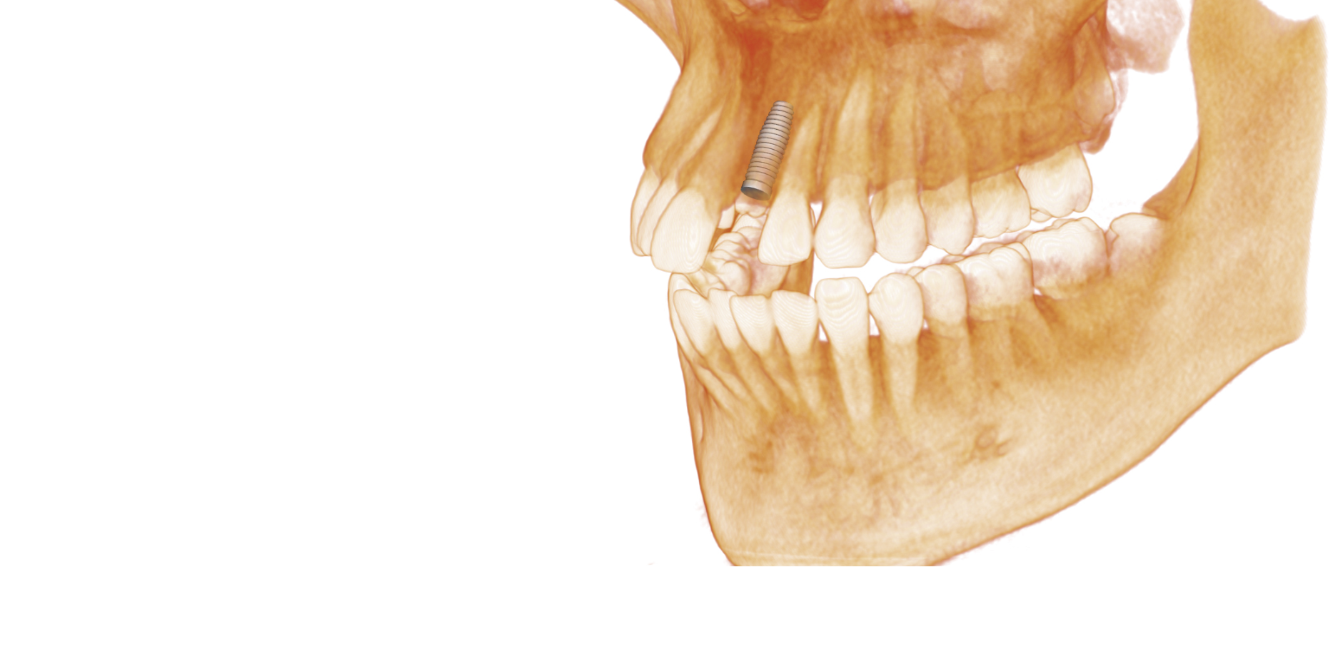 Anatomage In Vivo Viewer Anatomage In Vivo Viewer