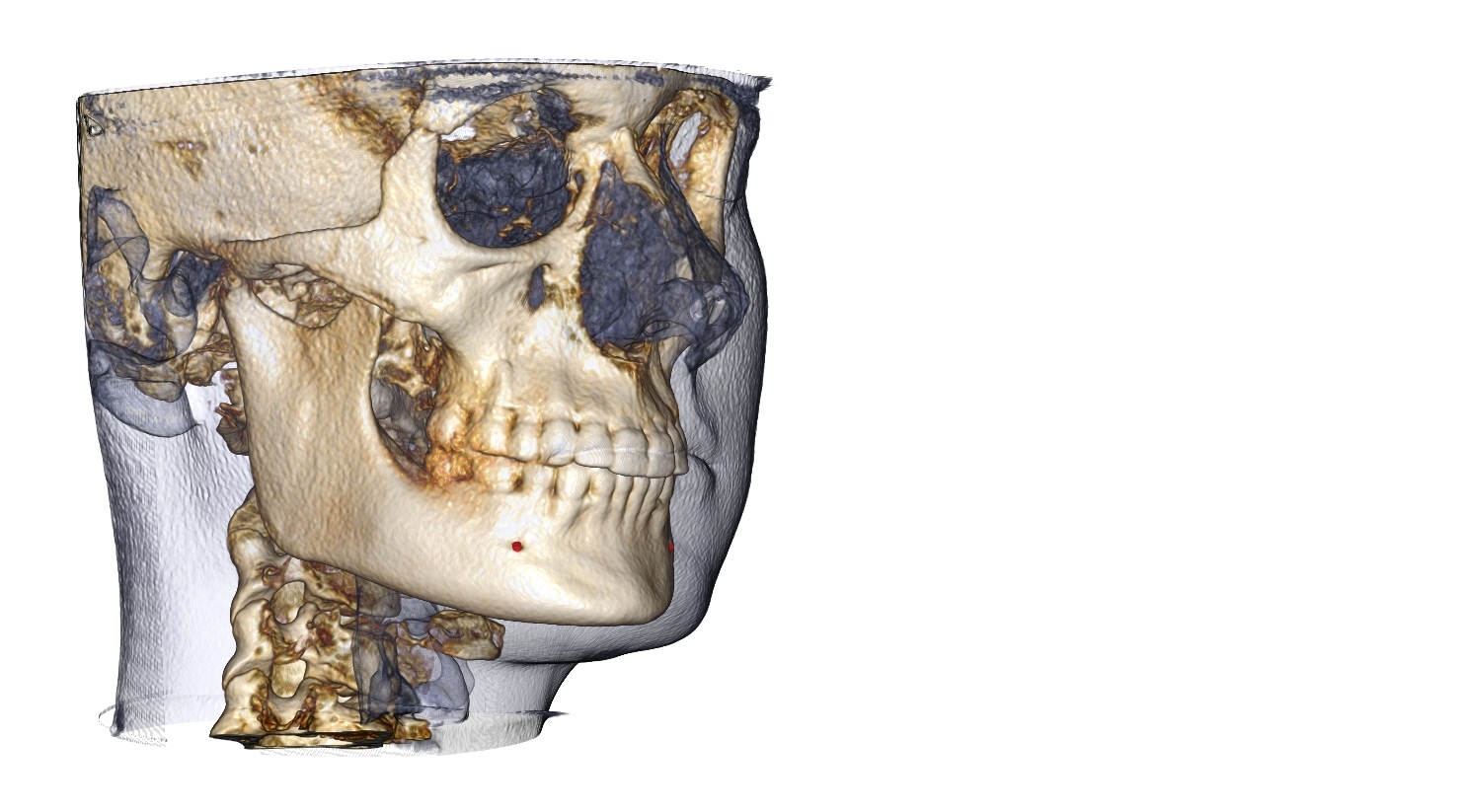 Anatomage In Vivo Viewer Anatomage In Vivo Viewer